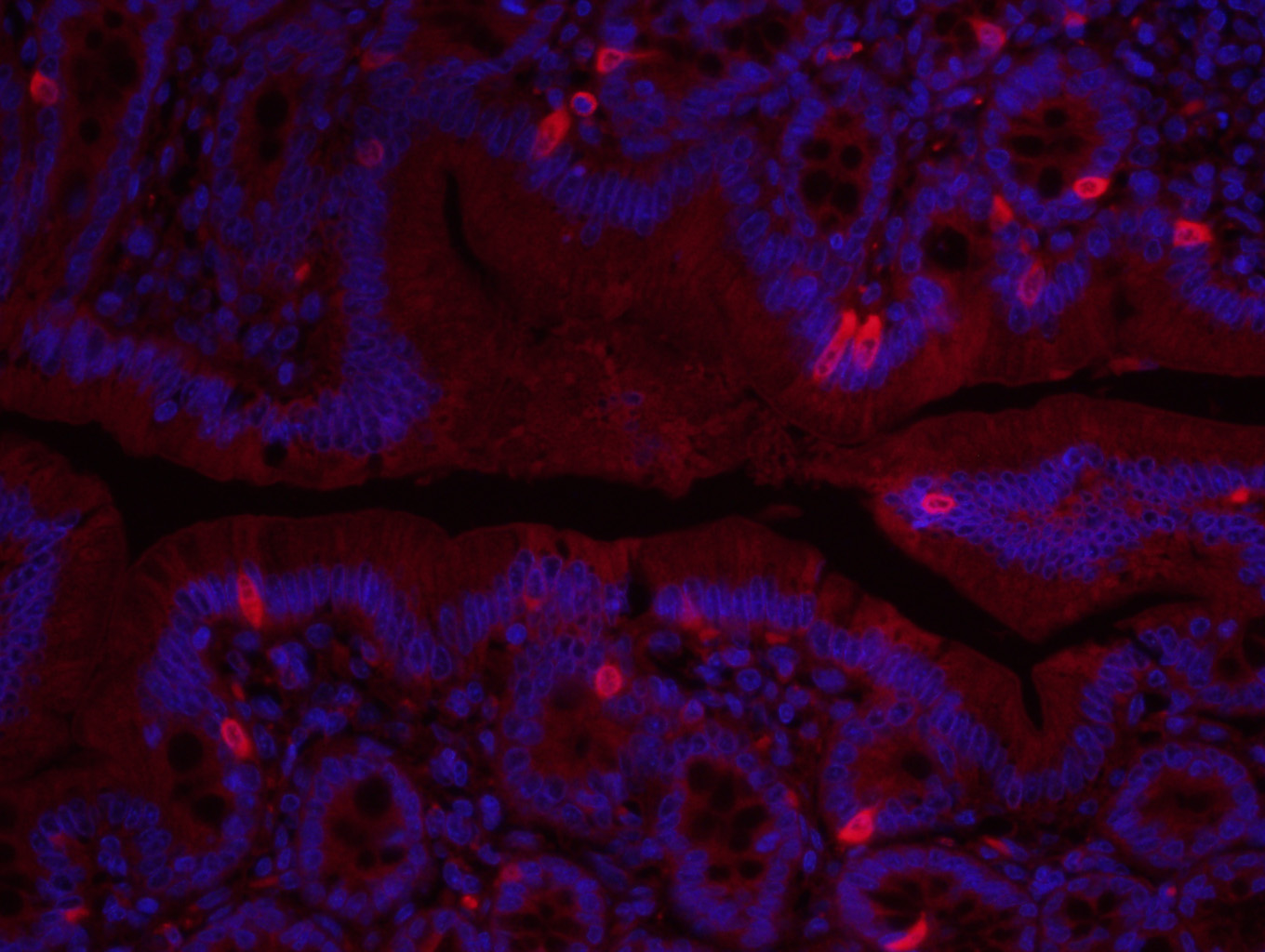 纤维连接蛋白抗体-bs-0666R
