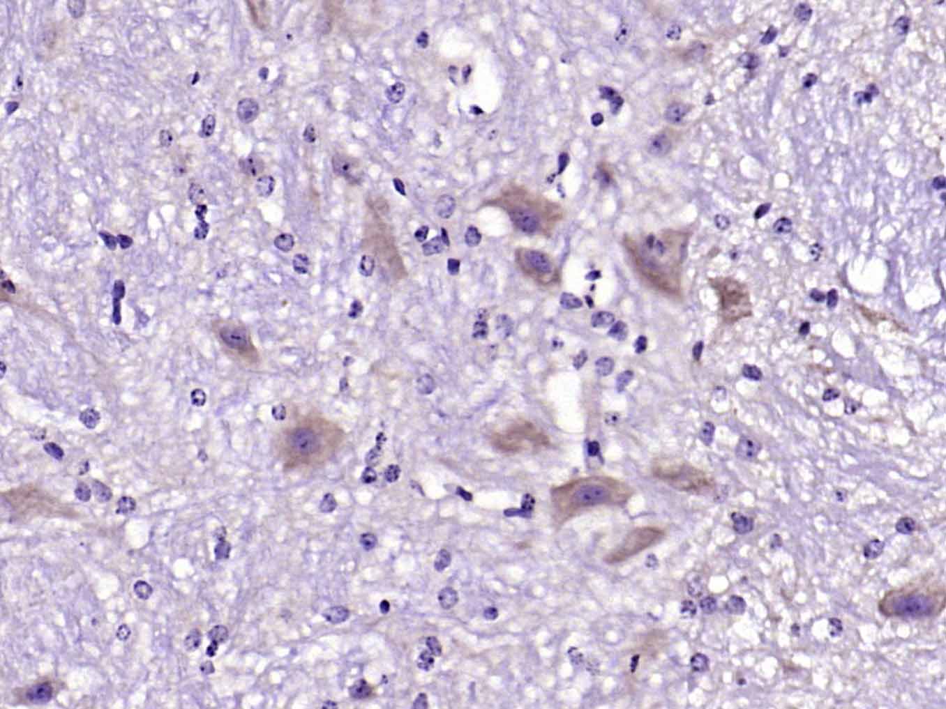 纤维连接蛋白抗体-bs-0666R