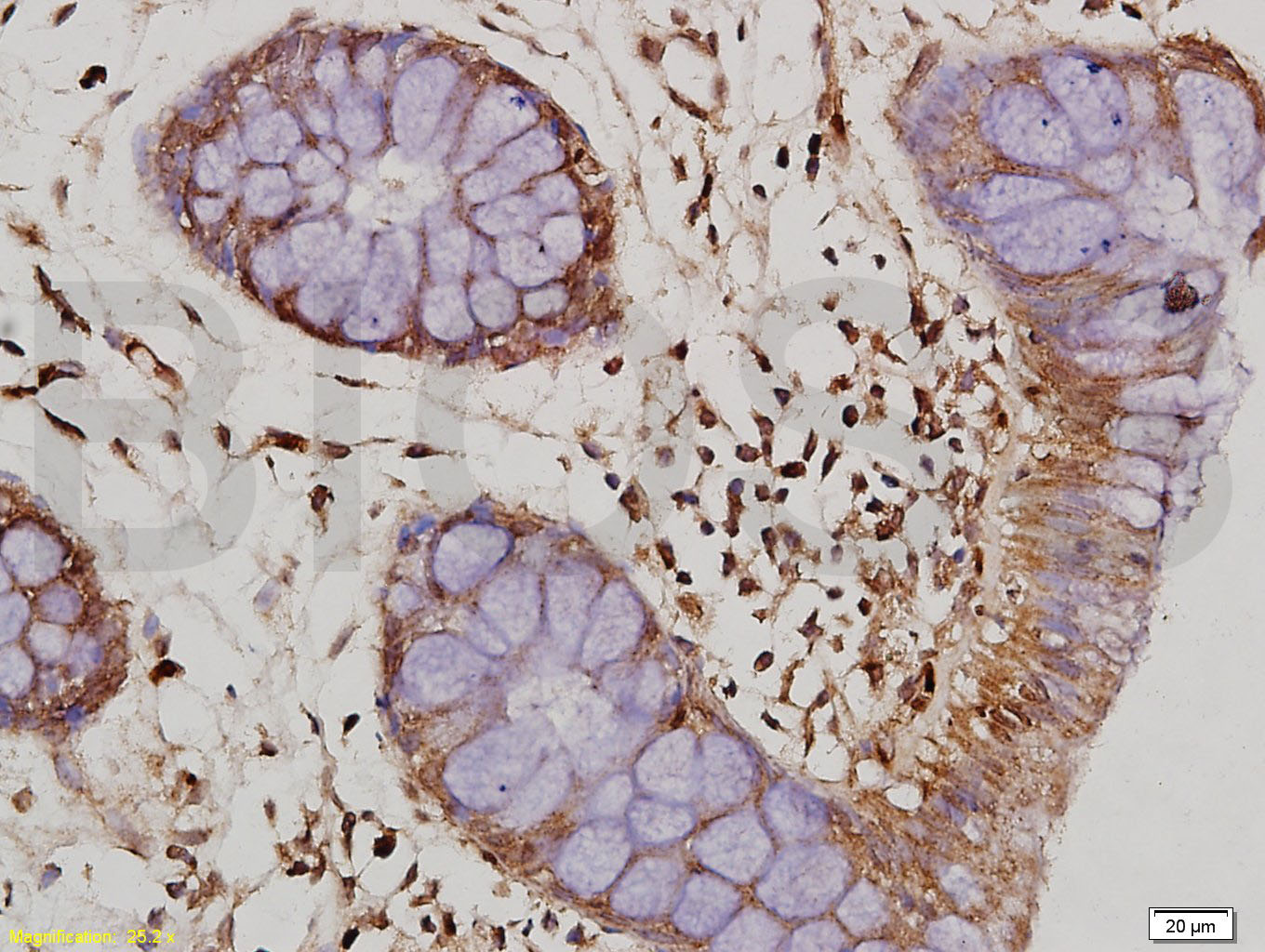 白细胞介素10抗体-bs-0698R