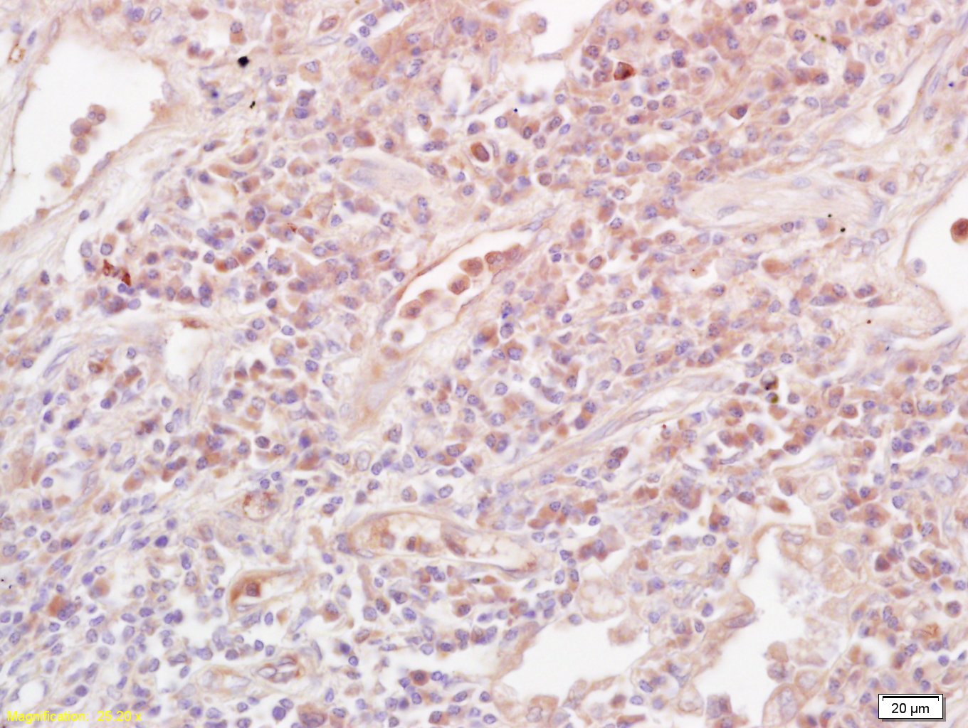 白细胞介素10抗体-bs-0698R