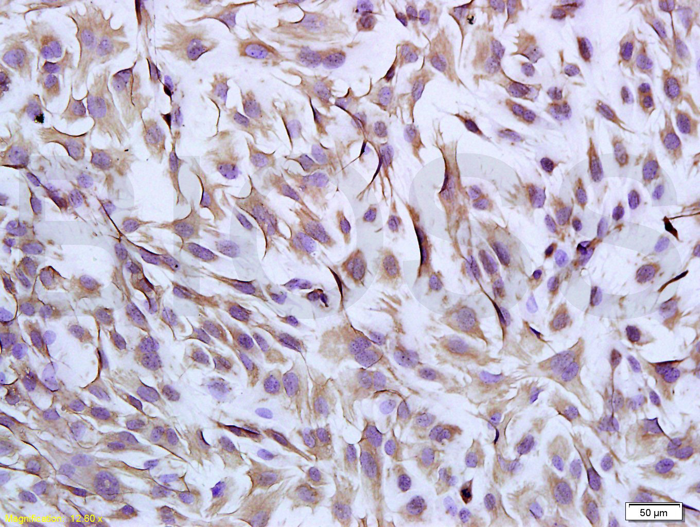 波形蛋白抗体-bs-0756R