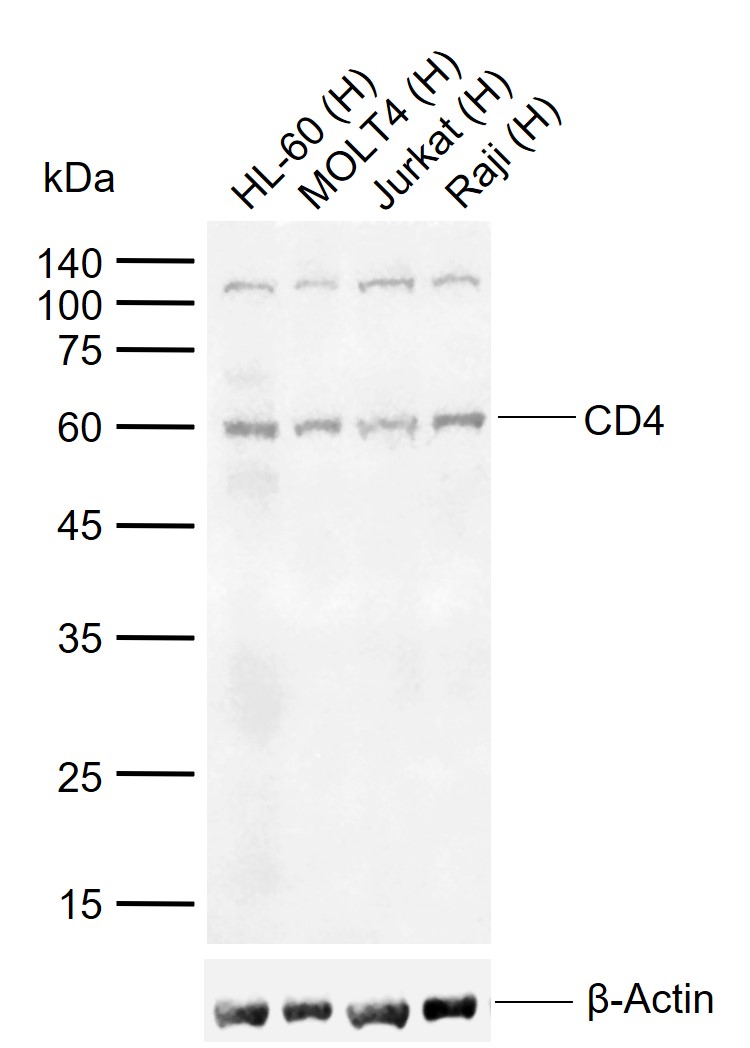 CD4 Rabbit pAb (一抗) | Bioss