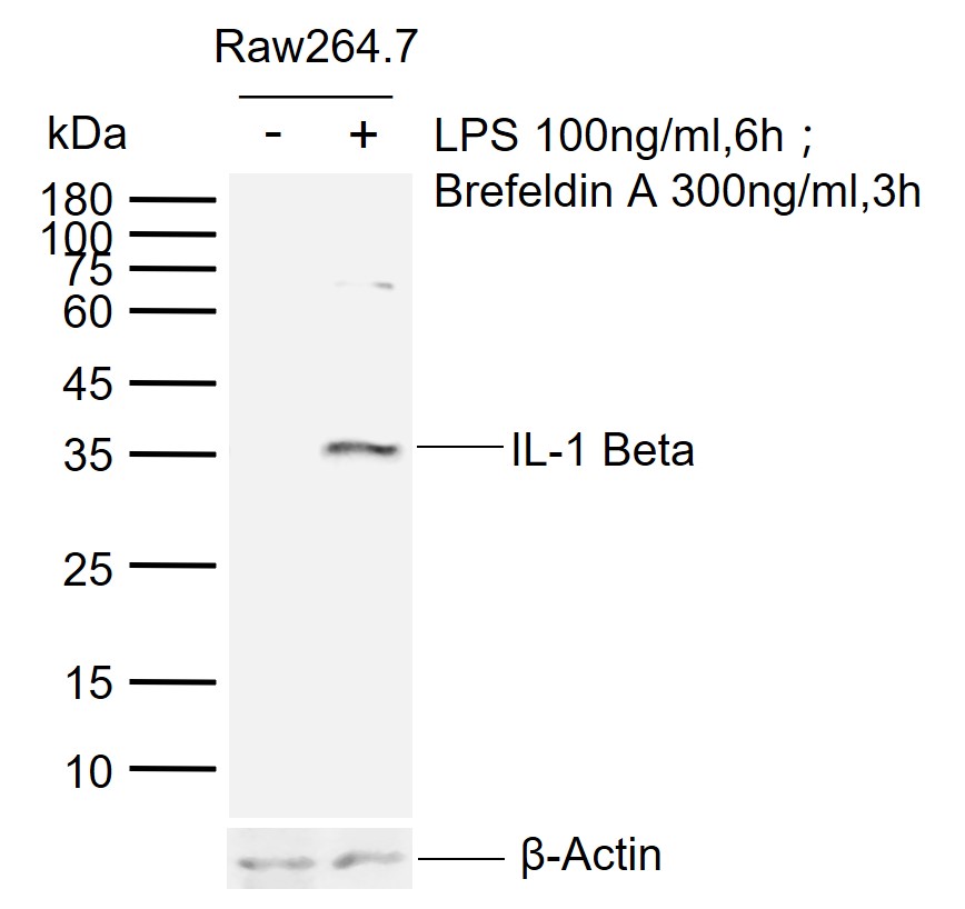 IL-1 Beta Rabbit pAb (一抗) - WB,IHC-P,IHC-F,IF | Bioss