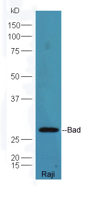 相关死亡促进因子Bad抗体-bs-0892R