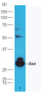 Bad Rabbit pAb (一抗) - WB,IHC-P,IHC-F,IF,Flow-Cyt | Bioss