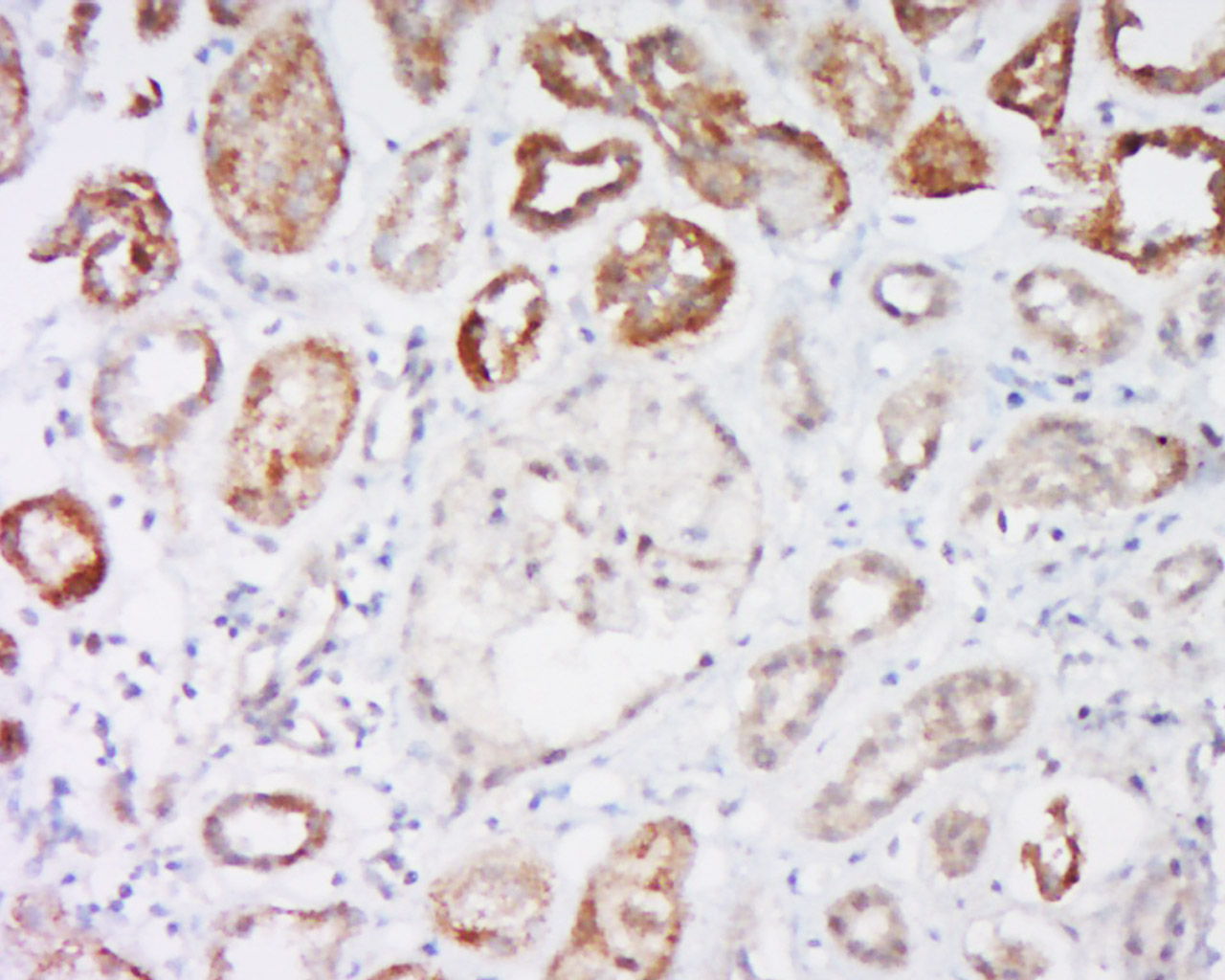 相关死亡促进因子Bad抗体-bs-0892R