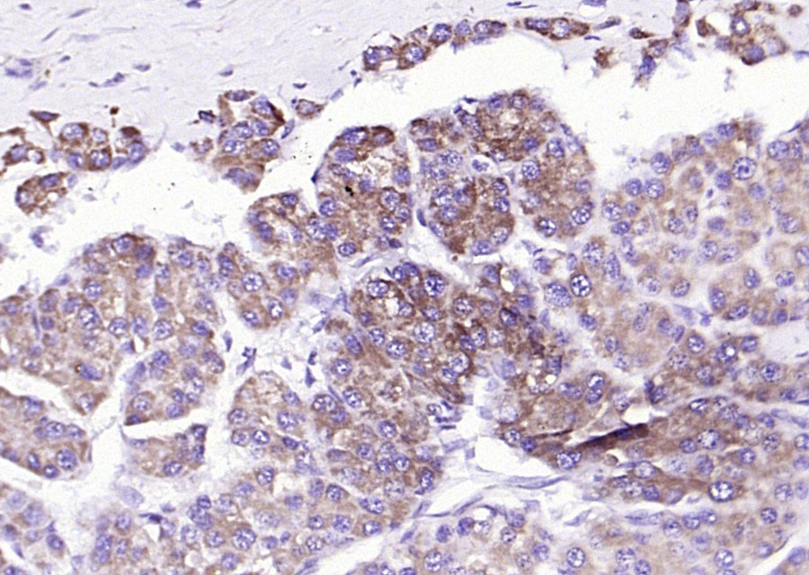 肝脏型脂肪酸结合蛋白抗体-bs-0897R
