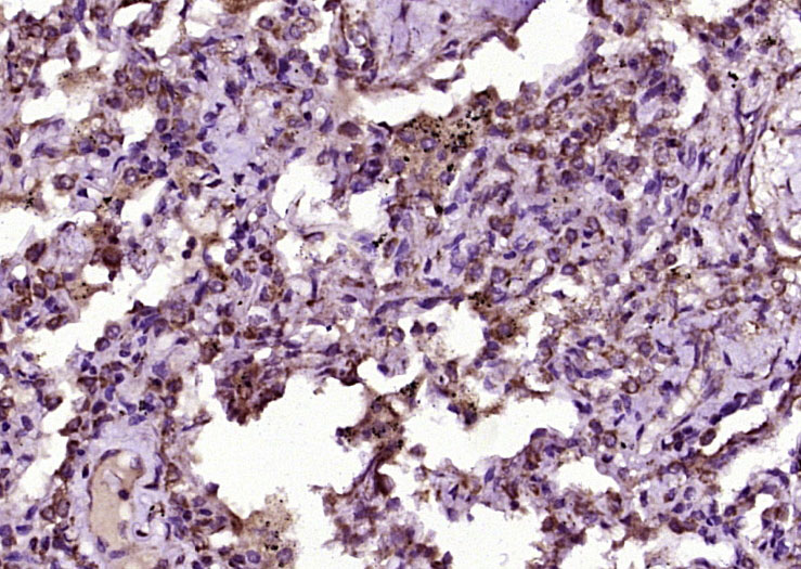 原癌基因蛋白c-kit（CD117）抗体-bs-10005R