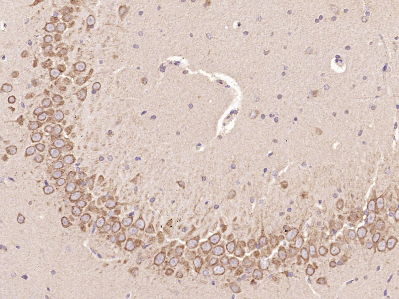 c-Kit Rabbit pAb (一抗) | Bioss