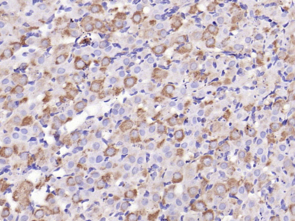 原癌基因蛋白c-kit（CD117）抗体-bs-10005R