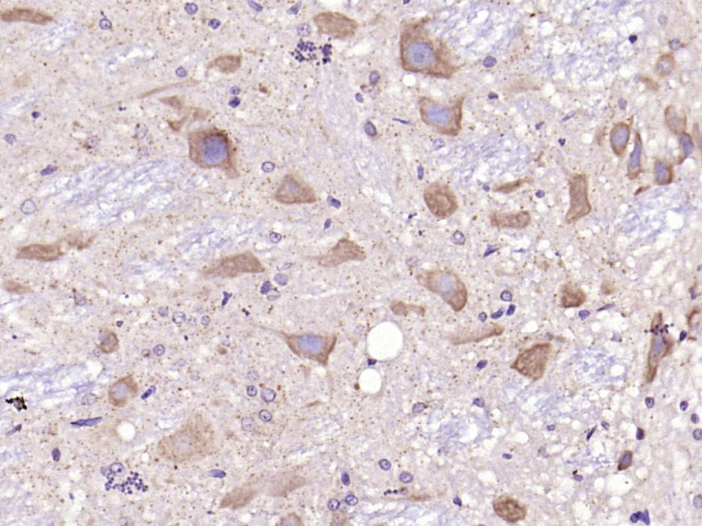 原癌基因蛋白c-kit（CD117）抗体-bs-10005R