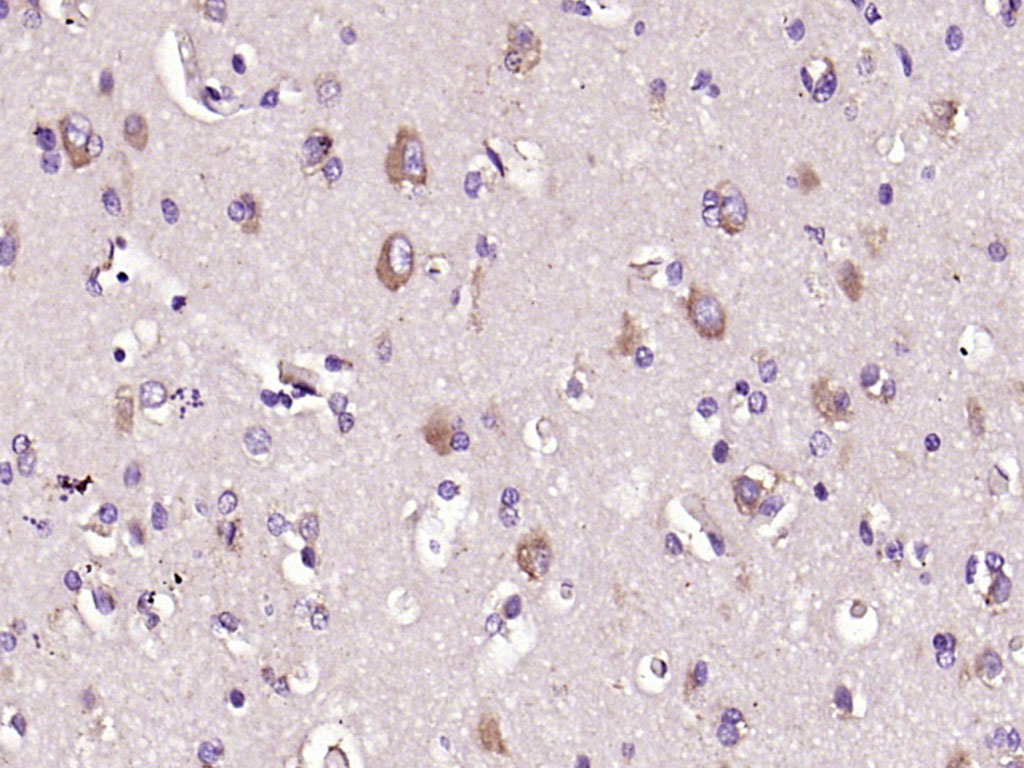 原癌基因蛋白c-kit（CD117）抗体-bs-10005R