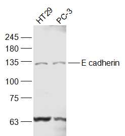 E cadherin Rabbit pAb (一抗) - WB,IHC-P,IHC-F,IF | Bioss