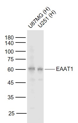 EAAT1 Rabbit pAb (一抗) | Bioss
