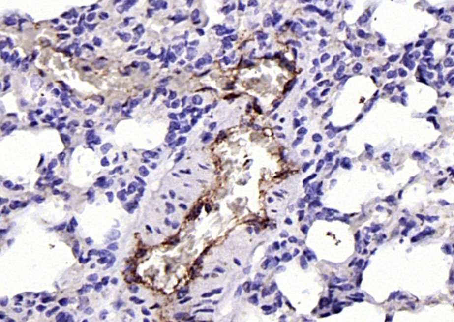 血管假性血友病因子/血管性血友病因子抗体-bs-10048R