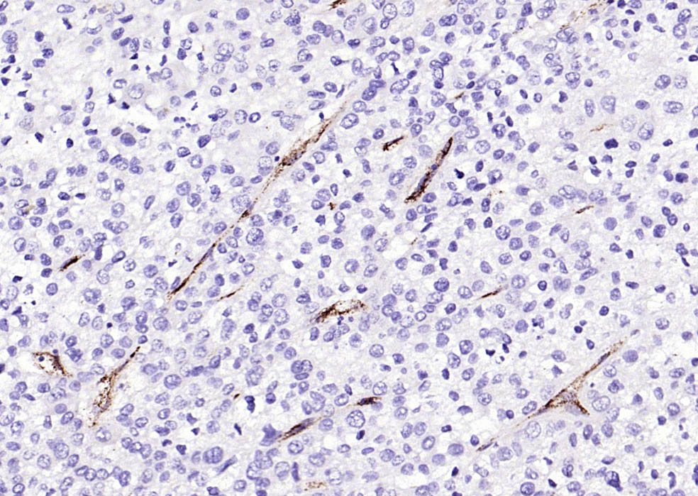 Von Willebrand Factor Rabbit pAb (一抗) - IHC-P,IHC-F,IF | Bioss