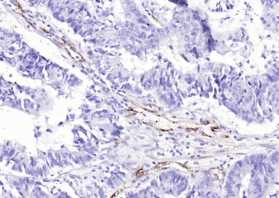 血管假性血友病因子/血管性血友病因子抗体-bs-10048R