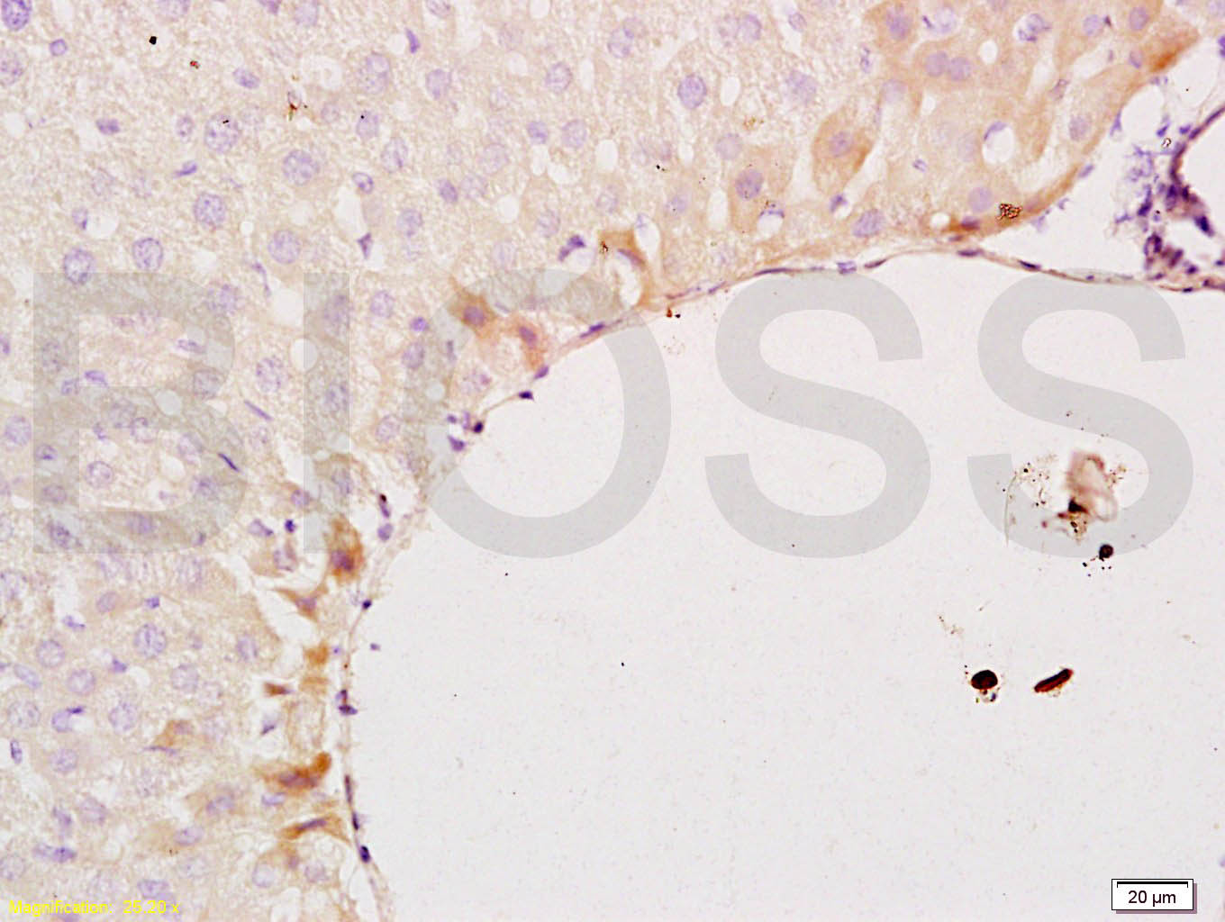 上皮钙粘附分子抗体-bs-1016R