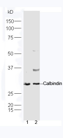 CALB1 Rabbit pAb (一抗) - WB,IHC-P,IHC-F,IF,ICC/IF | Bioss