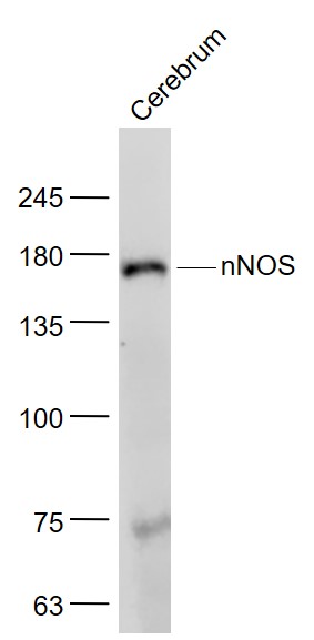 nNOS Rabbit pAb (一抗) - WB,IHC-P,IHC-F,IF | Bioss