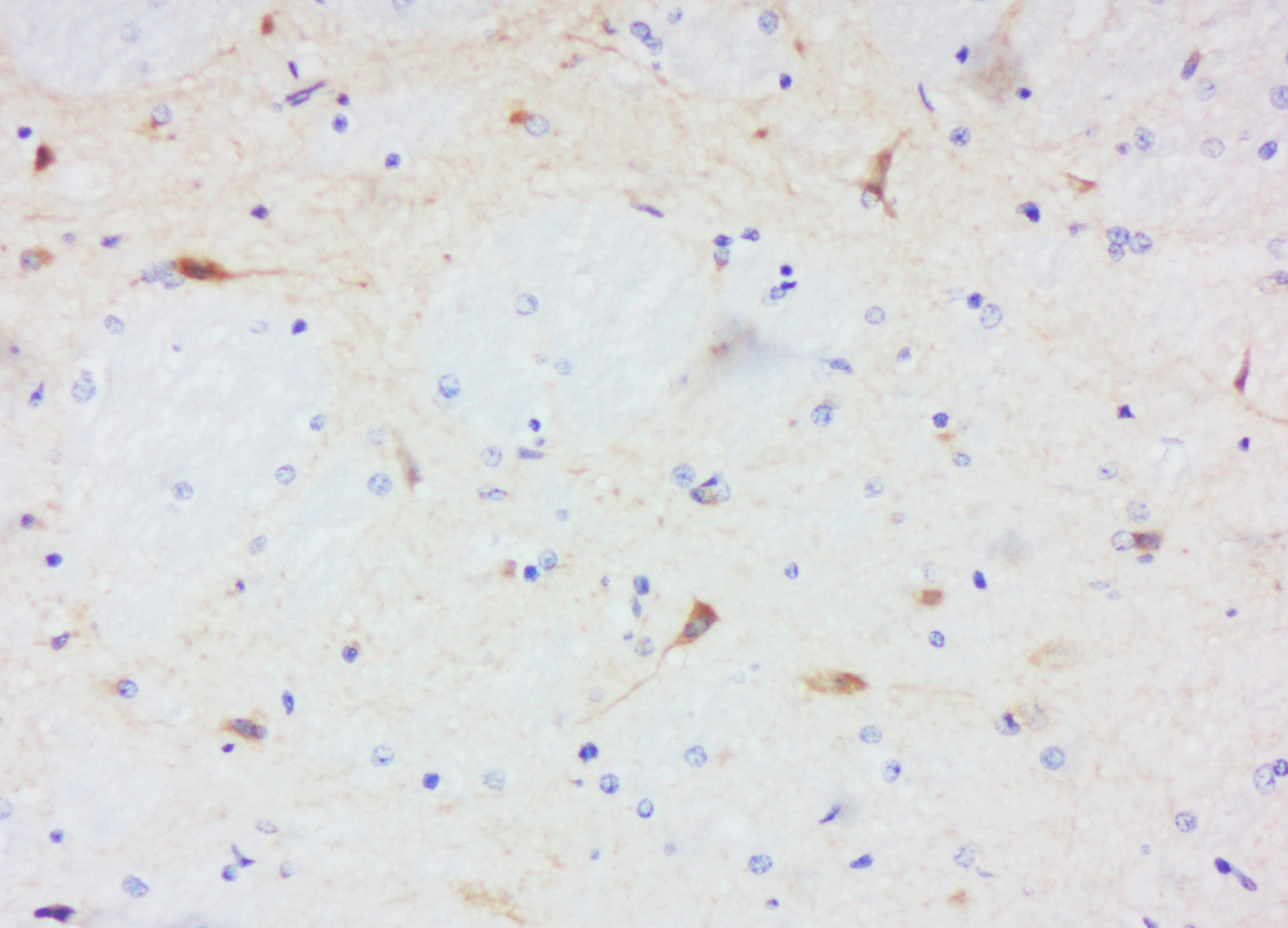 细胞色素c氧化酶IV亚型1抗体-bs-10257R