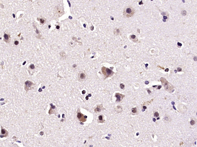 磷酸化细胞信号转导分子Smad-1抗体-bs-10381R