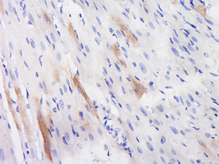 磷酸化细胞信号转导分子Smad-1抗体-bs-10381R