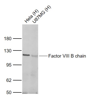 Factor VIII B chain Rabbit pAb (一抗) | Bioss
