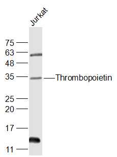 Thrombopoietin Rabbit pAb (一抗) | Bioss