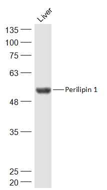 脂滴包被蛋白Perilipin-A抗体-bs-10779R