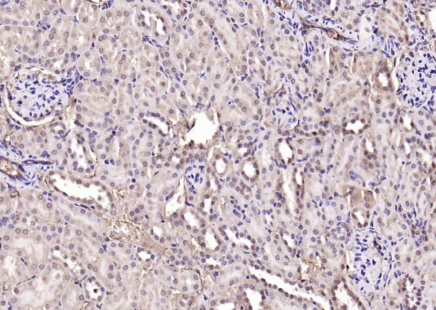 NADPH氧化酶4抗体-bs-1091R