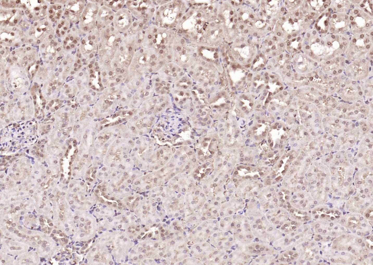 NADPH氧化酶4抗体-bs-1091R