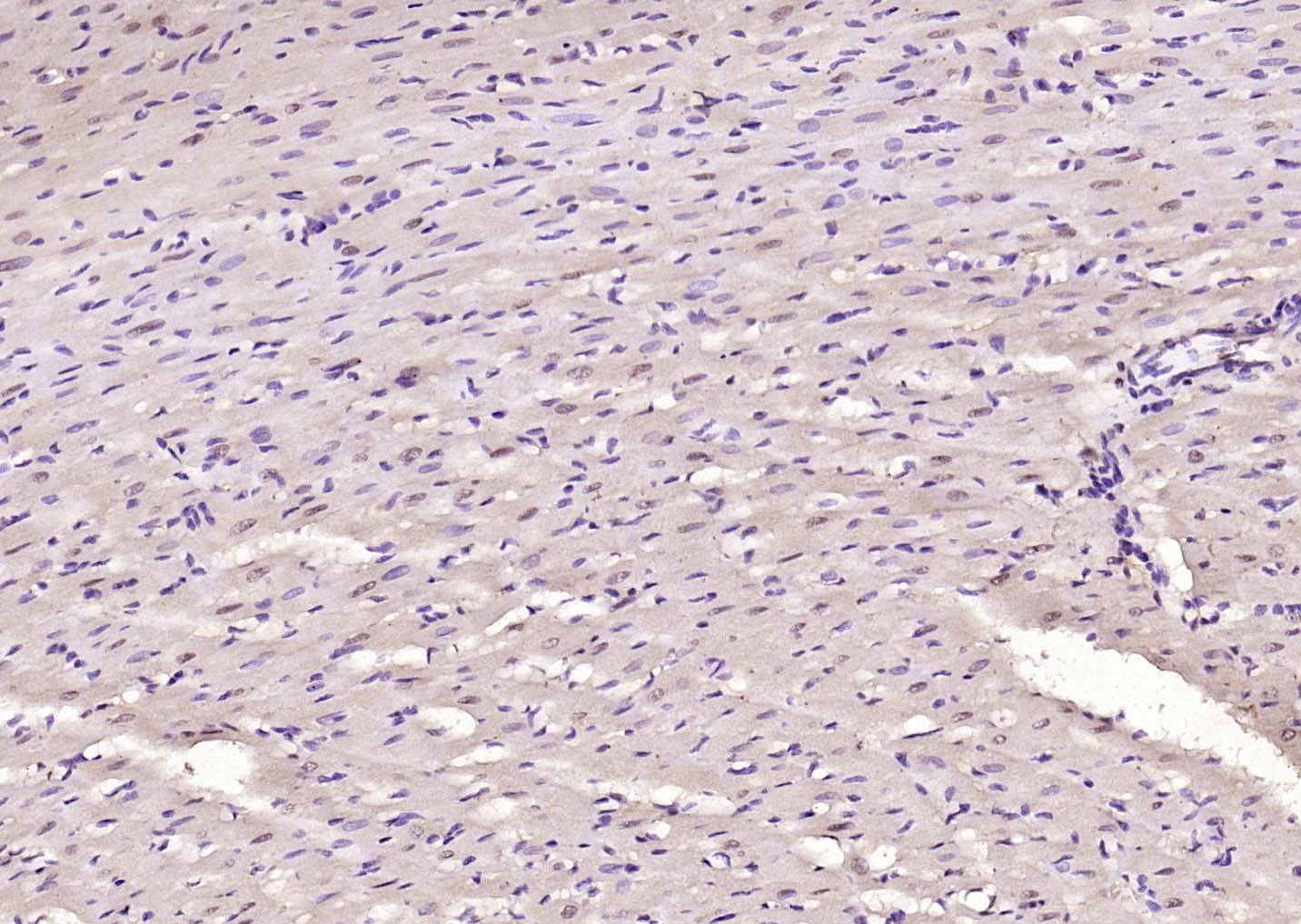 NADPH氧化酶4抗体-bs-1091R