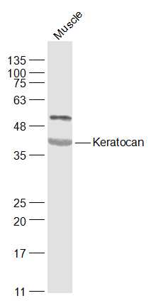 Keratocan Rabbit pAb (一抗) | Bioss