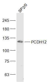 PCDH12 Rabbit pAb (一抗) | Bioss