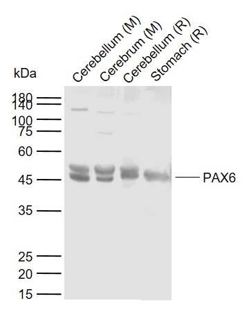 PAX6 Rabbit pAb (一抗) | Bioss