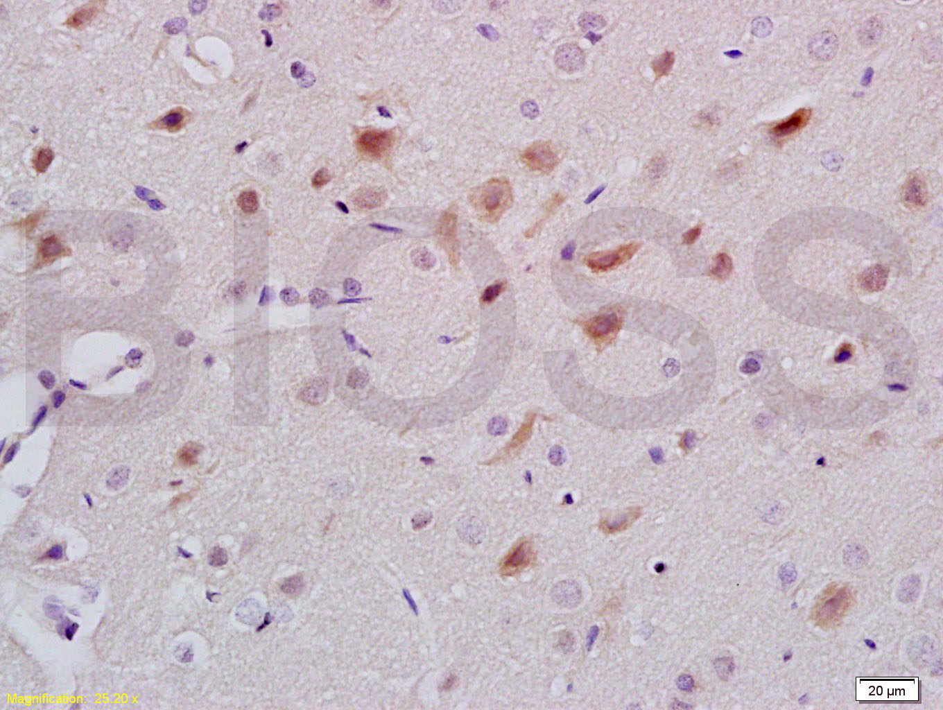 5-HT Rabbit pAb (一抗) - IHC-P,IHC-F,IF | Bioss