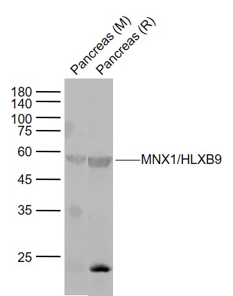 MNX1/HLXB9 Rabbit pAb (一抗) | Bioss