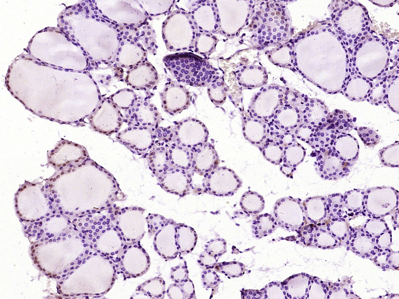 核心结合因子α1/成骨特异性转录因子/Cbfα1抗体
