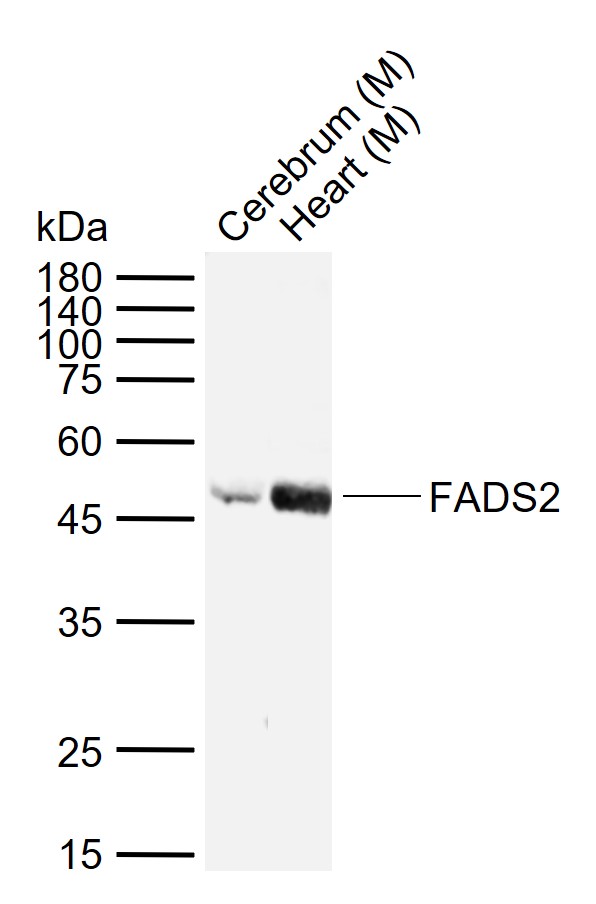 脂肪酸脱氢酶2抗体-bs-11516R