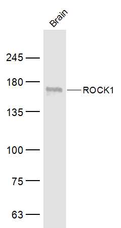 ROCK1 Rabbit pAb (一抗) - WB,IHC-P,IHC-F,IF | Bioss