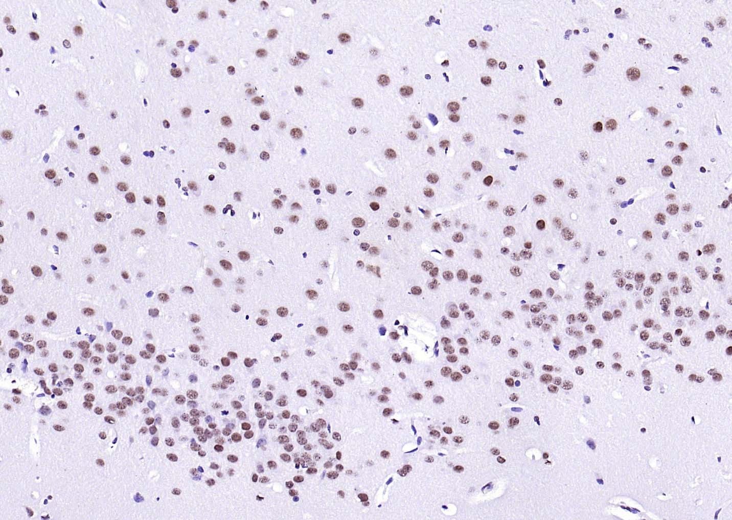 LMX1B Rabbit pAb (一抗) | Bioss