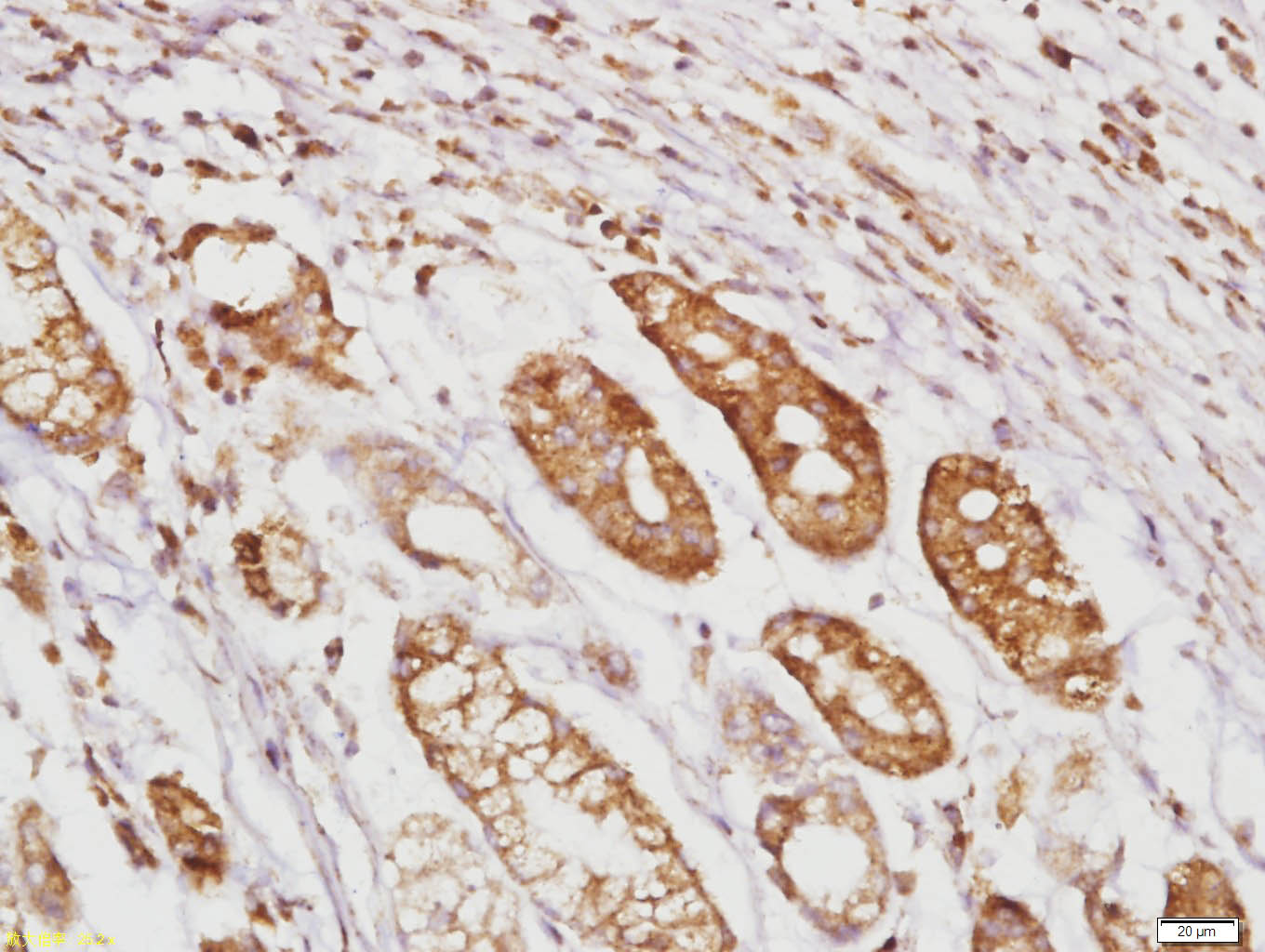 RhoA Rabbit pAb (一抗) - IHC-P,IHC-F,IF | Bioss