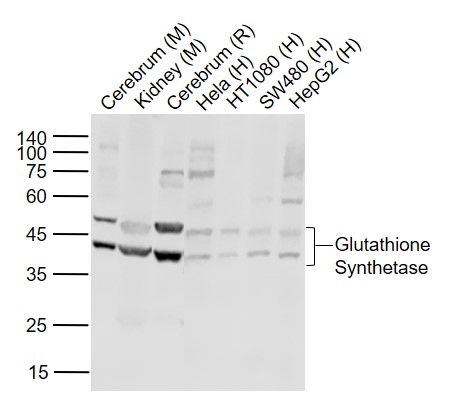 glutathione synthetase deficiency omim PDF) A case of severe with novel GSS mutations Riboflavin Responsive Mitochondrial Dysfunction in