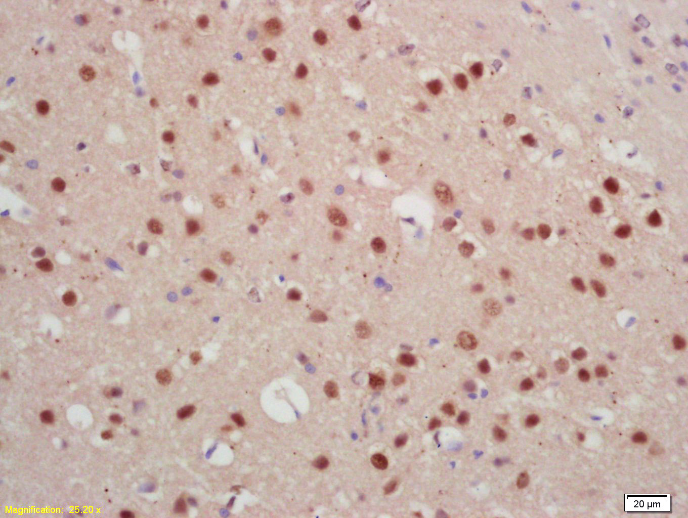 组蛋白去甲基化酶JARID2抗体-bs-11860R