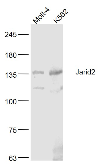 组蛋白去甲基化酶JARID2抗体-bs-11860R