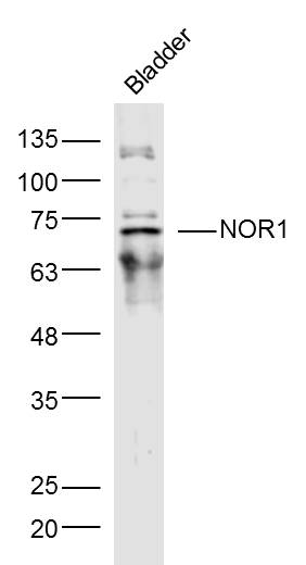NR4A3 Rabbit pAb (一抗) | Bioss
