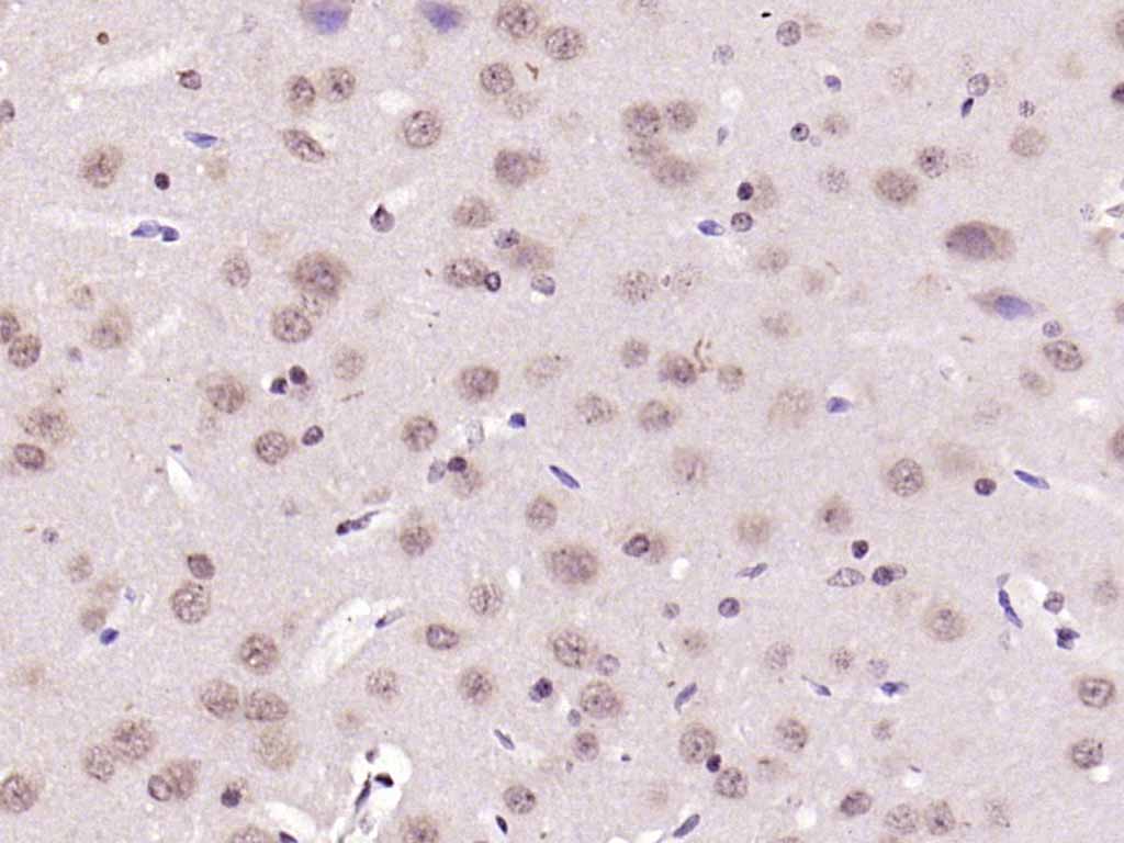 细胞核因子p50/k基因结合核因子抗体-bs-1194R