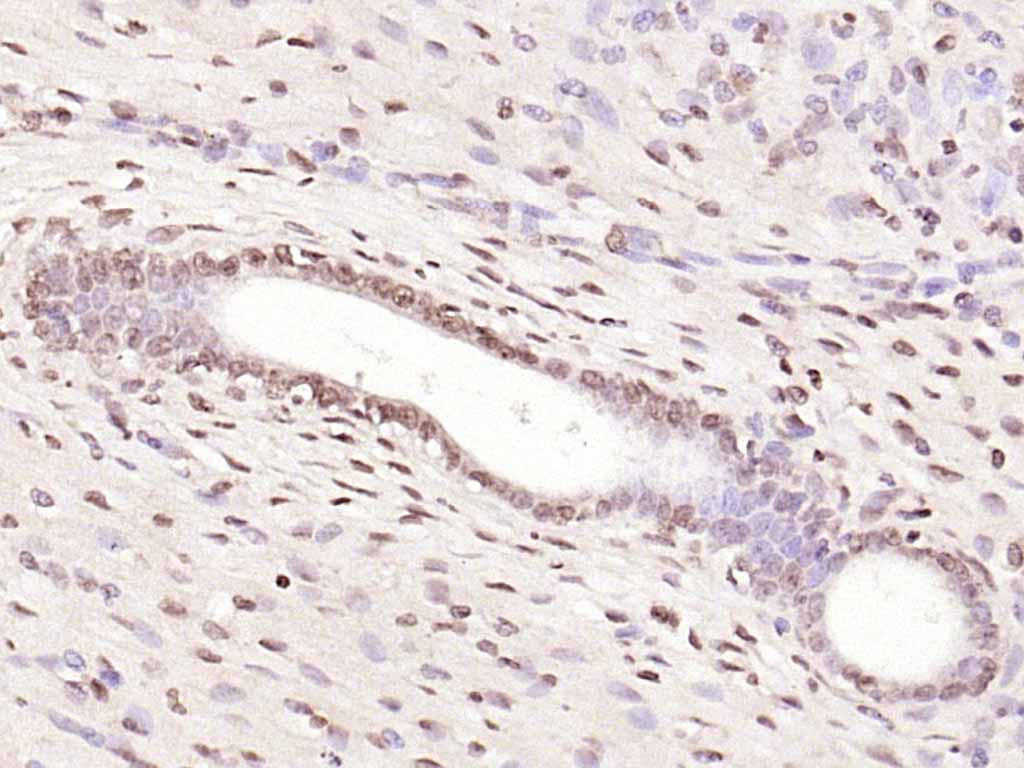 细胞核因子p50/k基因结合核因子抗体-bs-1194R