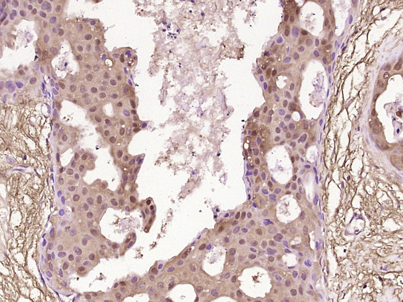 AKAP7 Rabbit pAb (一抗) | Bioss